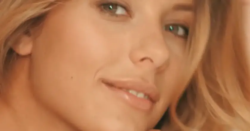 Camille Cerf, Miss France 2015, révèle souffrir d’une maladie invisible et douloureuse